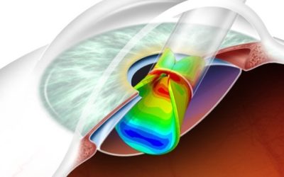 In Silico Design Verification Testing of Medical Devices